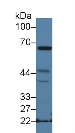 NCF2 / NOXA2 / p67phox Antibody (aa354-525, APC)