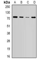 IHC-plus™ WHSC1 / NSD2 Antibody