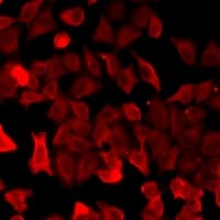 SFTPC / Surfactant Protein C Antibody