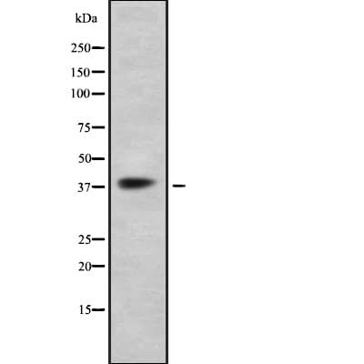 FFAR3 / GPR41 Antibody