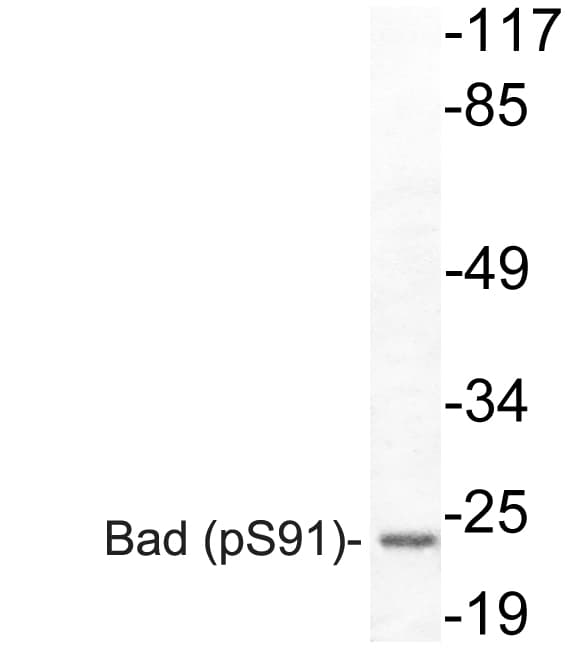 BAD Antibody (phospho-Ser91)