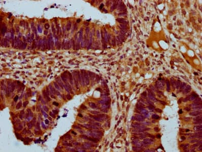 THNSL2 Antibody
