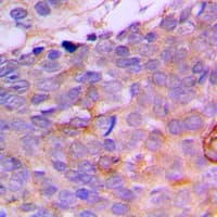 CRABP2 Antibody (Internal)