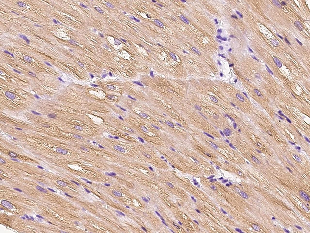 HSPB8 / H11 / HSP22 Antibody