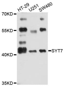 SYT7 / Synaptotagmin 7 Antibody
