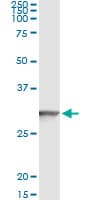 Monoclonal Mouse anti-Human GSTT2 Antibody (clone 1C12, WB)