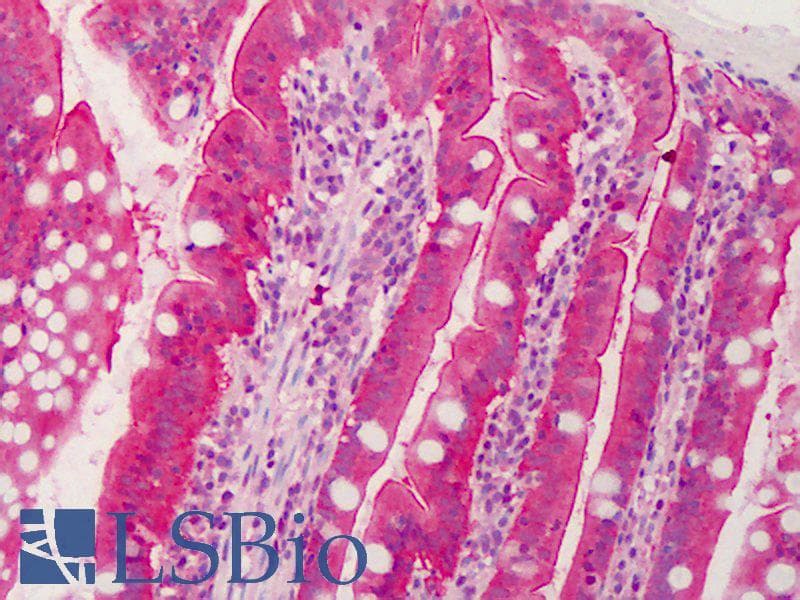 IHC-plus™ C1QTNF6 / CTRP6 Antibody