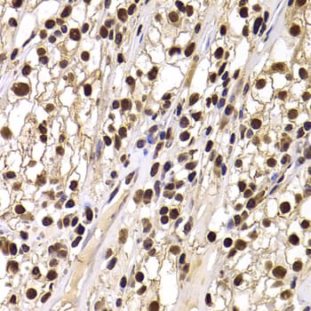 Polyclonal Rabbit anti-Human HIRIP3 Antibody (IHC, IF, WB)