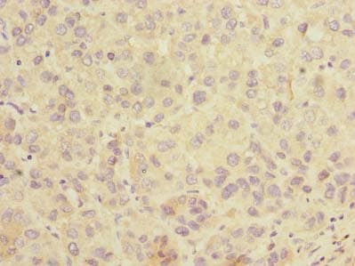 SLC25A36 Antibody