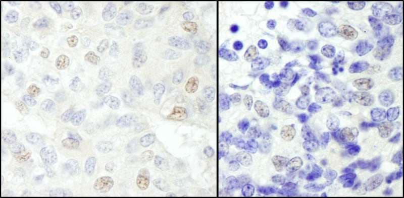Polyclonal Rabbit anti-Human SNW1 / SKIP Antibody (aa500-C-term, IHC, WB)