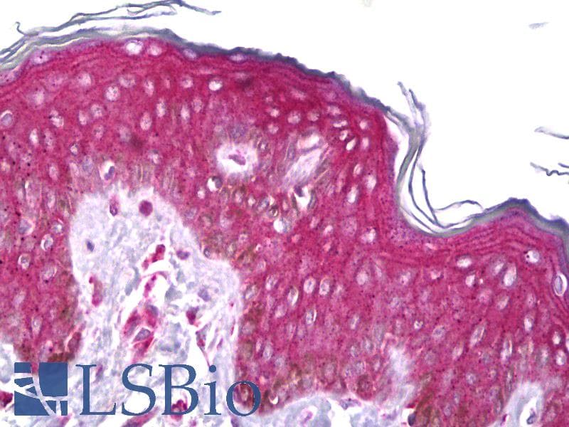 IHC-plus™ Polyclonal Rabbit anti-Human RET Antibody (aa152-182, IHC, WB)