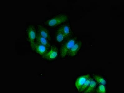 ASGR2 Antibody