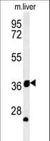 Polyclonal Rabbit anti-Human TRAF1 Antibody (aa55-83, WB)