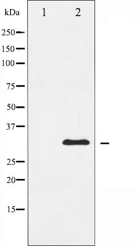 HNRNPC / HNRNP C Antibody