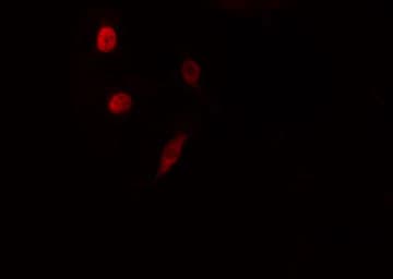 NEUROD1 Antibody