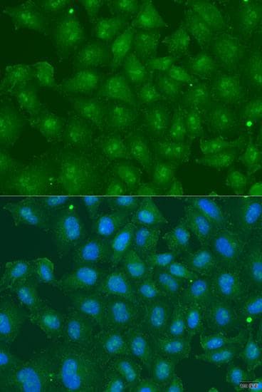Polyclonal Rabbit anti-Human ZBTB20 Antibody (IF)