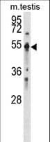 Polyclonal Rabbit anti-Human PTP1B Antibody (aa221-249, WB)