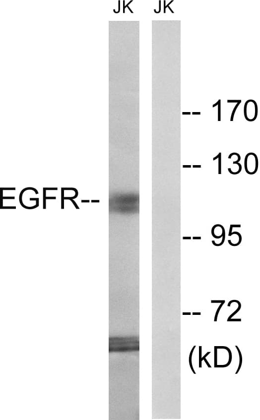 EGFR Antibody (aa966-1015)