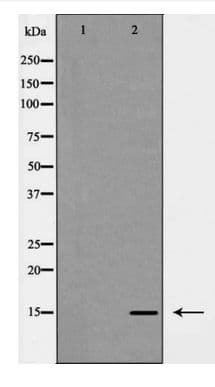 LGALS7 / Galectin 7 Antibody