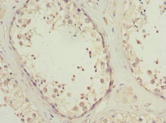 PIK3R3 / p85 Gamma Antibody