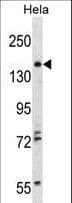 TNIK Antibody (aa1-30)