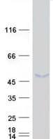 Human SUNC1 / SUN3 Protein (Recombinant Myc-DDK (Flag))