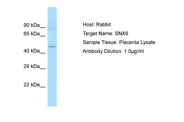 SNX6 Antibody (aa208-257)