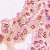 Polyclonal Rabbit anti-Human RPS6KB2 / S6K2 Antibody (C-Terminus, IHC, WB)