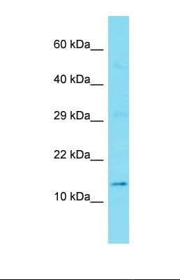 GTSCR1 Antibody (aa20-69)
