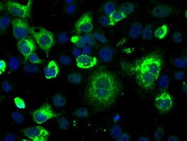 IHC-plus™ LOX / Lysyl Oxidase Antibody (clone 9A11)