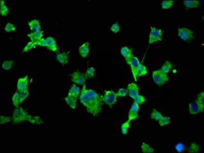 Polyclonal Rabbit anti-Human SCN10A / Nav1.8 Antibody (IF, WB)