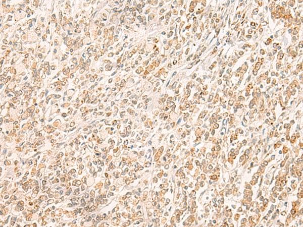 MYCT1 Antibody
