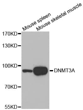 DNMT3A Antibody