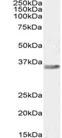 LGALS12 / Galectin 12 Antibody