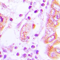 Polyclonal Rabbit anti-Human NOS2 / iNOS Antibody (C-Terminus, IHC, IF, WB)