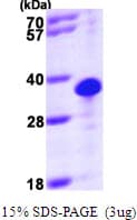 Human THTPA Protein (Recombinant His)