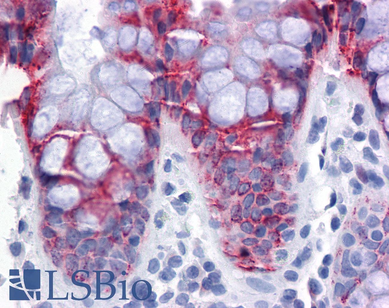 IHC-plus™ Monoclonal Mouse anti-Human EPSTI1 Antibody (clone 2A8, IHC, WB)