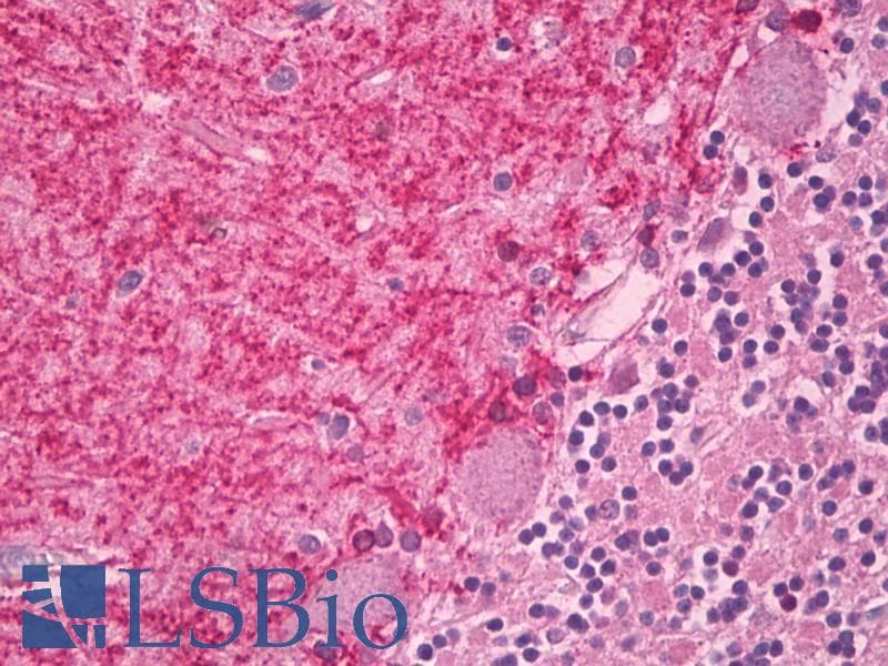CNR1 / CB1 Antibody (aa73-122)