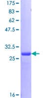 Human BRCA1 Protein (Recombinant GST)