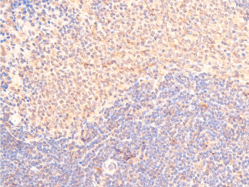 TP53 / p53 Antibody (phospho-Ser15)