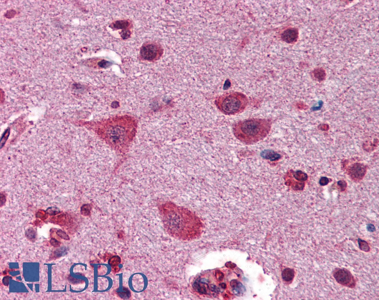 GSK3B / GSK3 Beta Antibody (aa326-375)