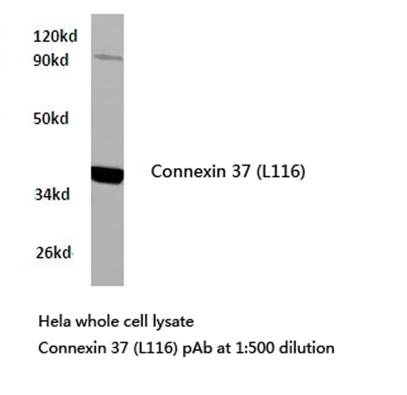 Polyclonal Rabbit anti-Human GJA4 / CX37 / Connexin 37 Antibody (Leu116, WB)