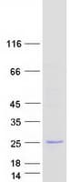 Human URAD / PRHOXNB Protein (Recombinant Myc-DDK (Flag))