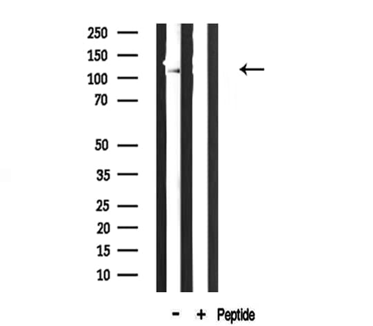 COL6A2 / Collagen VI Alpha 2 Antibody