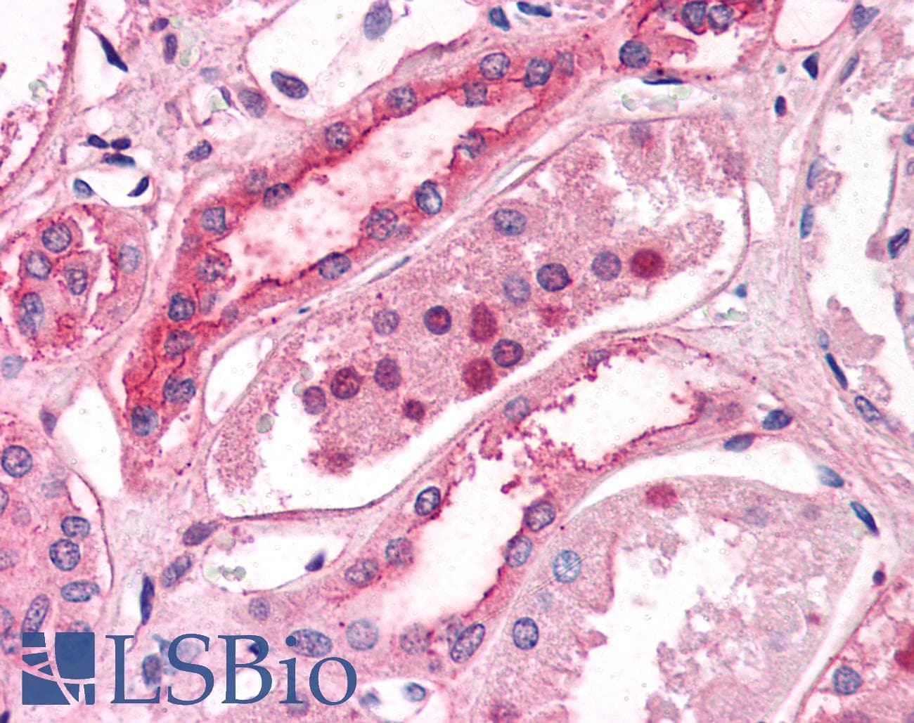 IHC-plus™ Polyclonal Rabbit anti-Human SLC39A14 / ZIP14 Antibody (Internal, IHC)