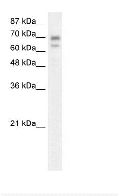 Hairless / HR Antibody (aa697-746)