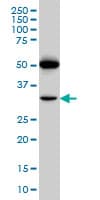 Monoclonal Mouse anti-Human PTGIR / IP Receptor Antibody (clone 4B10, WB)