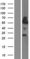 CAMK2D / CaMKII Delta Protein (Over-Expression Lysate Myc-DDK (Flag))