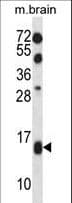 Polyclonal Rabbit anti-Human TCEB2 / Elongin B Antibody (aa2-29, WB)
