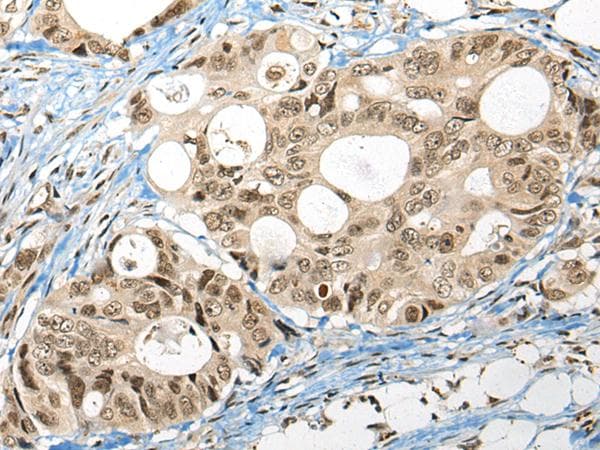 FUT4 / CD15 Antibody